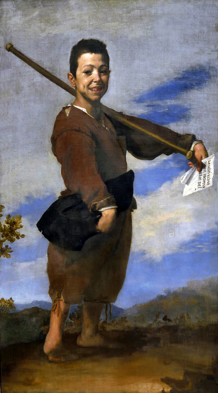 Painting showing boy standing, aged approximately 7 years old wearing earth coloured clothes in front a bright and cloudy background. The boy is stood sideways on with a crutch over his left shoulder. On closer inspection you can see the boy has a club foot and the arms are shown extended at the elbows, with bent wrists. These are all typical presentations of Arthrogryposis.